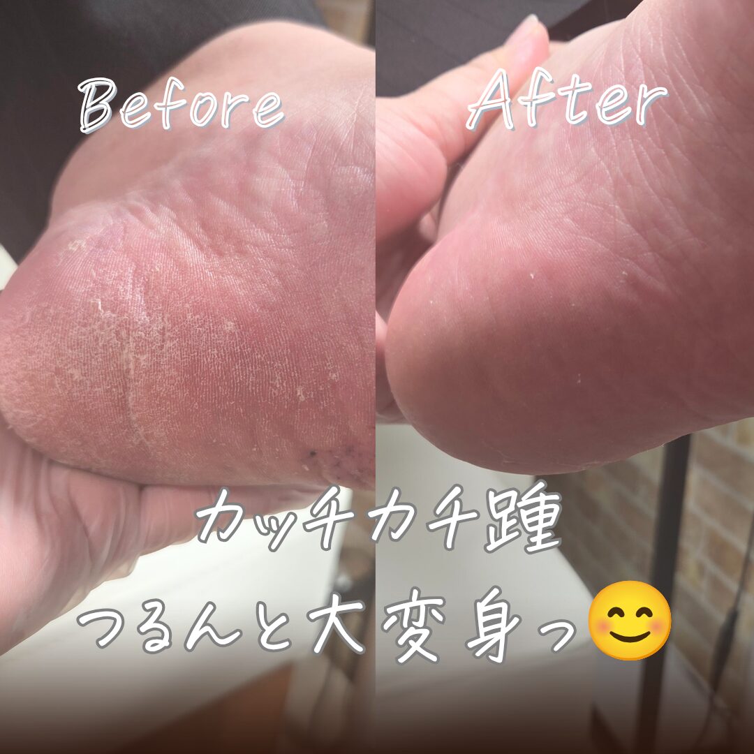 小杉 愛由美 さんのフットケア　リラクゼーション　結．