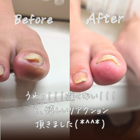 小杉 愛由美 さんのフットケア　リラクゼーション　結．｜フットケアサロン