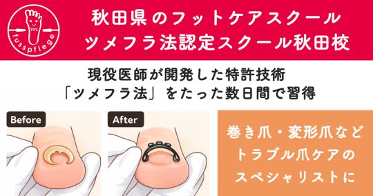 ツメフラ法認定スクール 秋田校|フットケア推進室 ツメフラ法認定スクール 秋田校|フットケア推進室