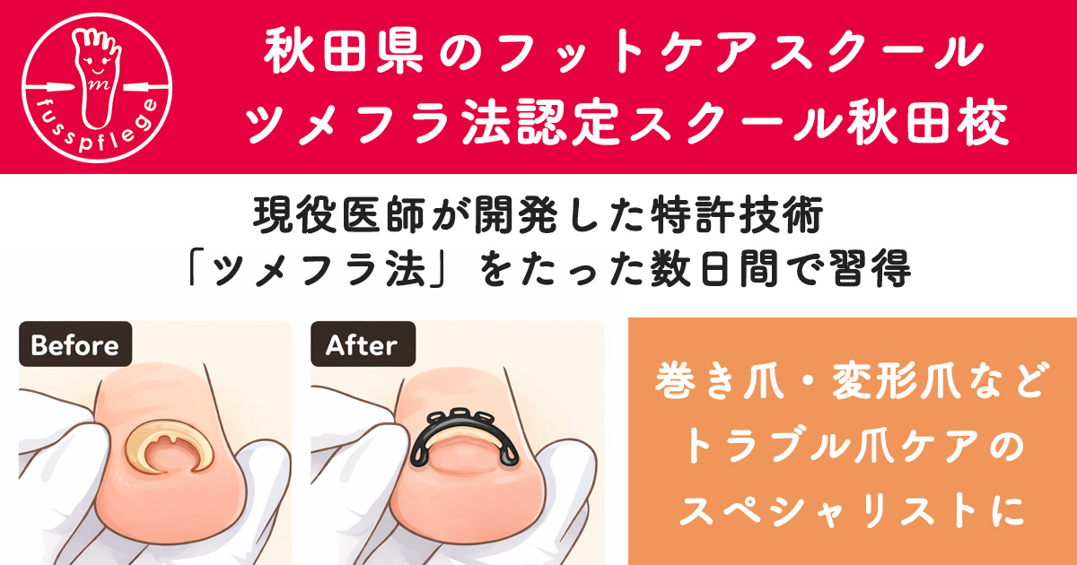 秋田県のフットケアスクール｜ツメフラ法認定スクール 秋田校