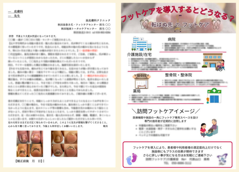 フットケア集客を病院などからのご紹介獲得で安定